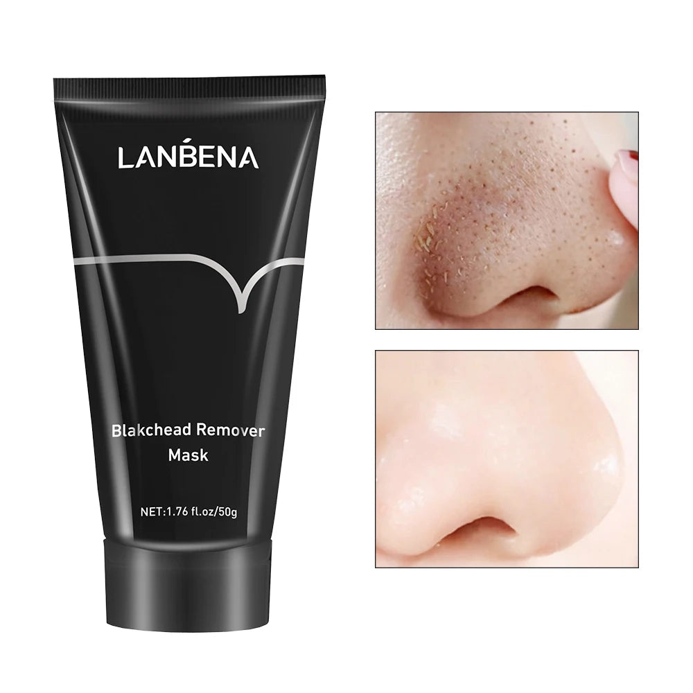 LANBENA Blackhead Remover Black Mask